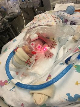 a very small preemie in an incubator at a hospital