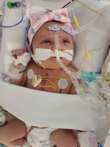 an infant in her NICU bed hooked up to machines