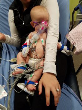 A baby hooked up to medical equipment