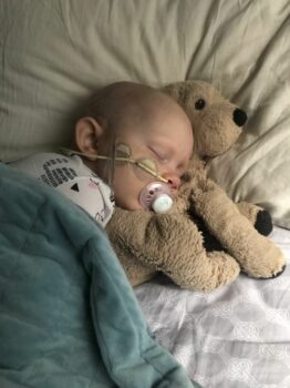 A little girl with a feeding tube sleeps with her head on her stuffed dog