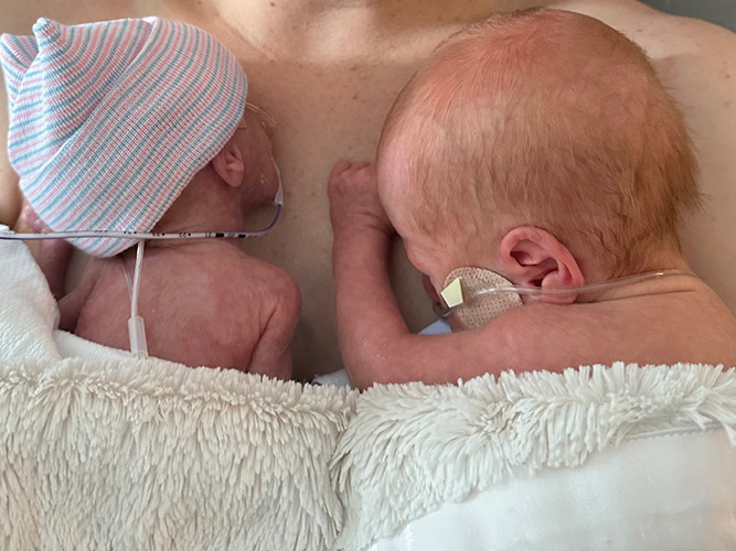 Two newborn twins laying on their parent's chest