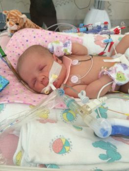 a preemie hooked upto machines in the NICU