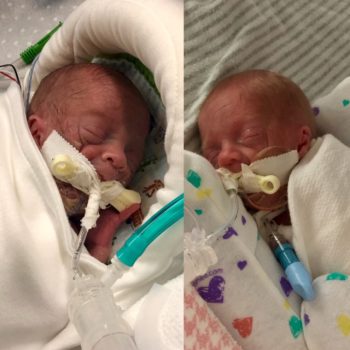 two micro preemies in the hospital