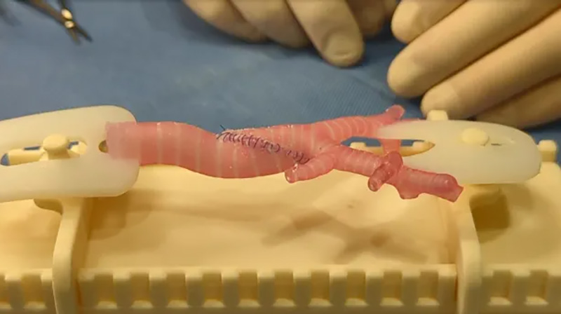 3-D printed airway model