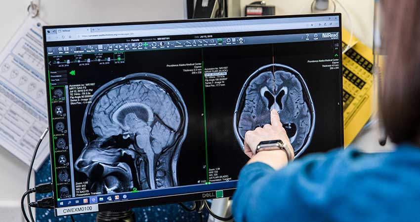 Dr. Sarah Leary looking at a computer scan of a brain