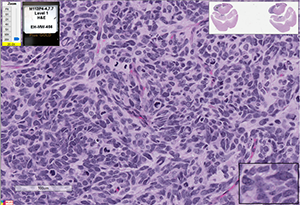 Med-113FH cells