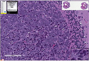 Med-2112FH cells