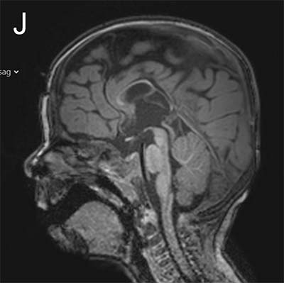 Medical image of a brain