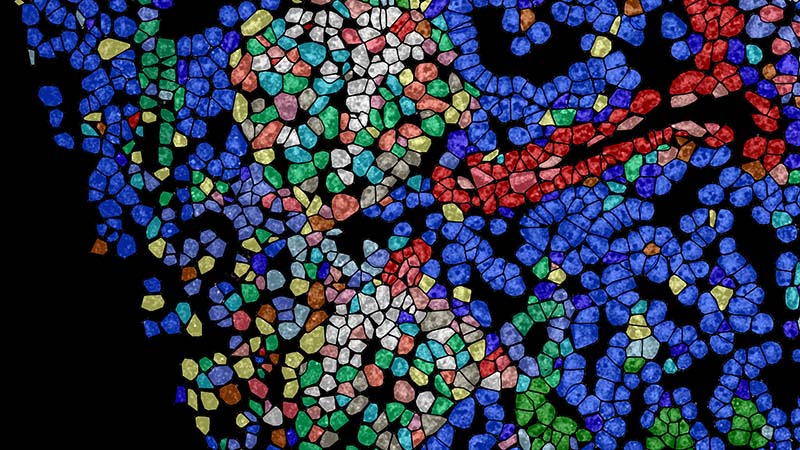 Cells of human kidney with lupus nephritis made to look like stained glass in microscopy image.